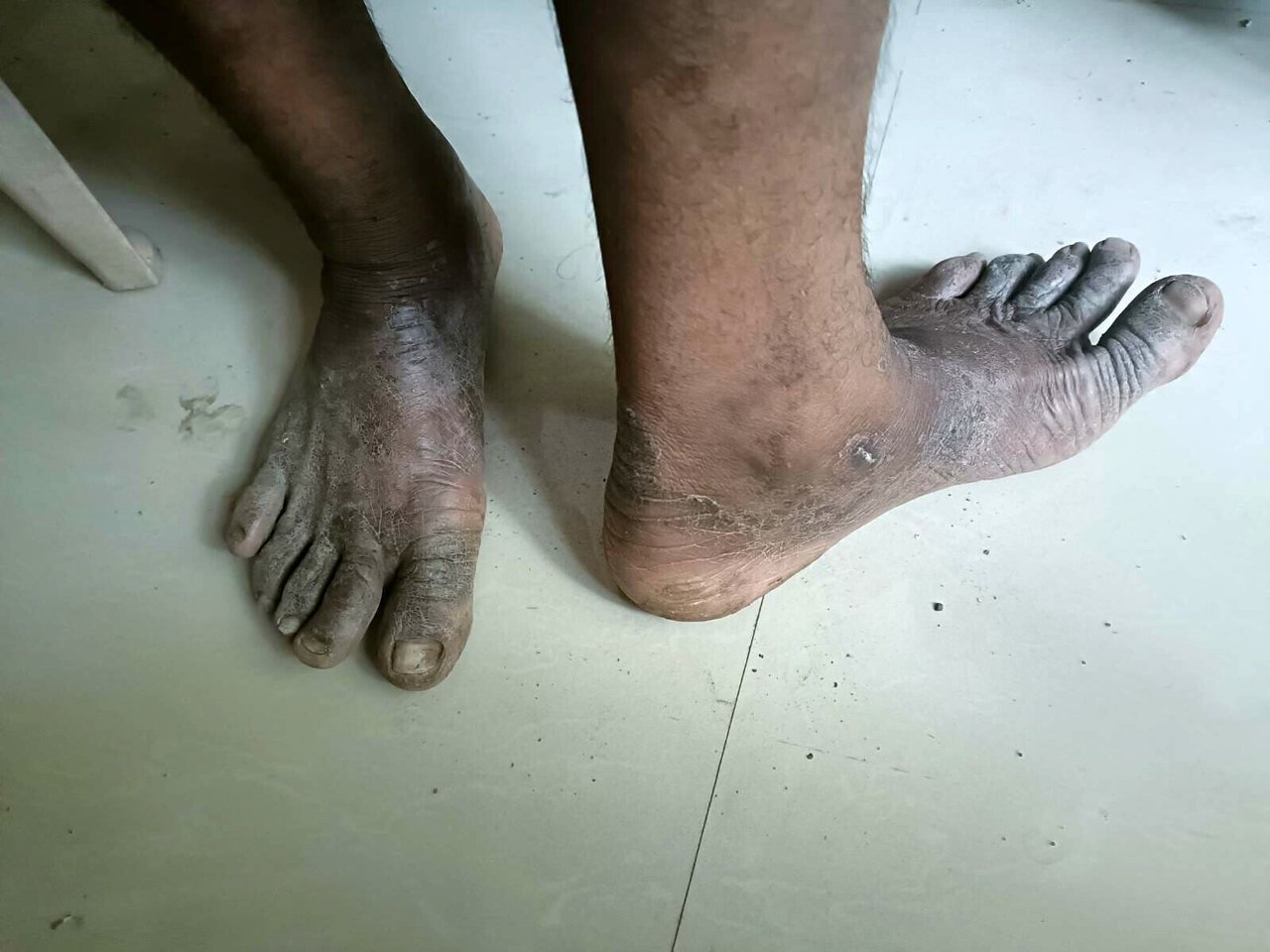 2023 06 Well Digging Case Survivor Feet 3 jpeg 202306 MUM Well Digging Rescue Approved for Full Use